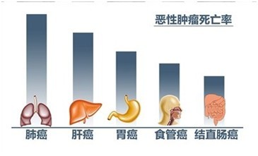 马云说，“10年以内，肺癌、肝癌、胃癌将光临每一个中国家庭，我担心我们这么努力，最后所挣的钱都是医