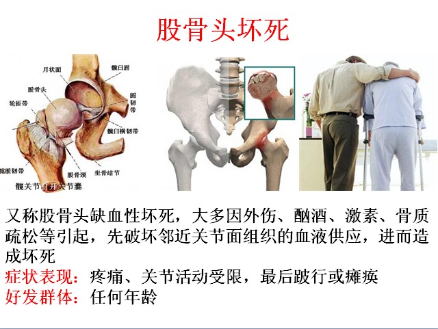 主要针对:颈肩不好,腰椎间盘突出,坐骨神经痛,中风后遗症,骨股头坏死