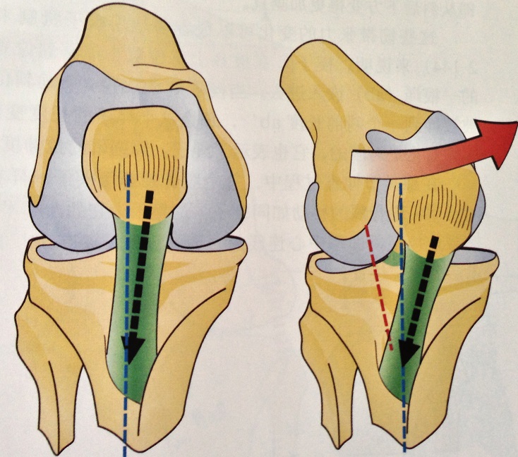 膝关节损伤——检测篇