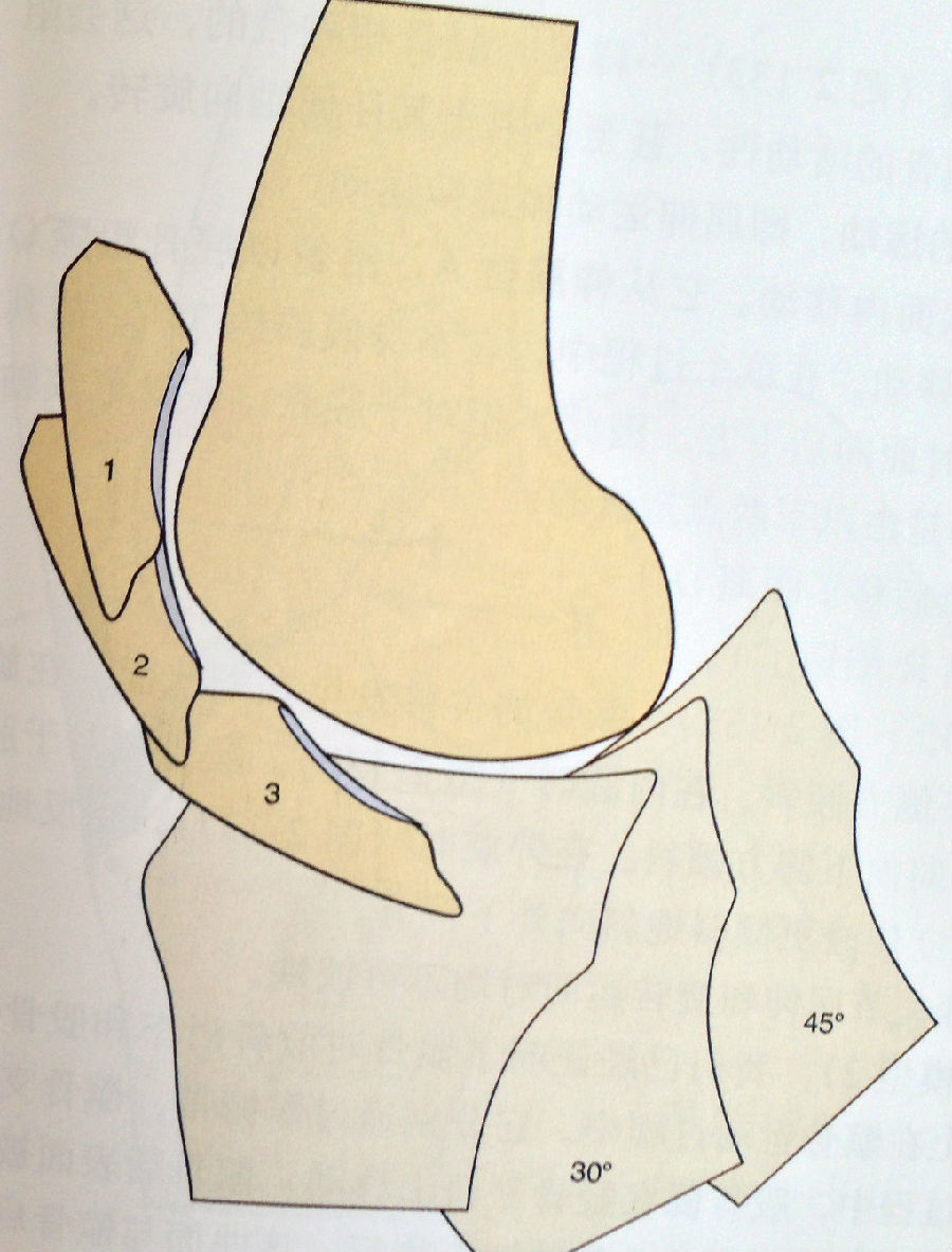 屈曲10--20·时髌骨下及内外侧关节面同时与股骨滑车接触 屈曲20·时