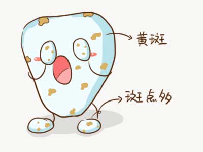 牙菌斑:牙齿发黄         牙菌斑会影响宝宝的乳牙生长,但是只要常