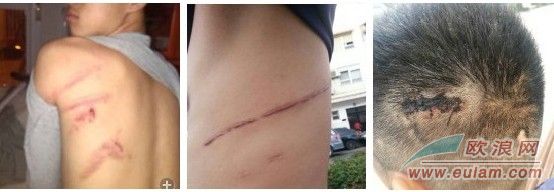 华人食品店父子被警察勒索和殴打事件：“苍蝇不叮无缝的蛋”