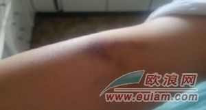 侨胞递交材料屡次触发警报引发事端 当事人遭保安强行阻拦
