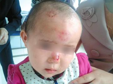 巴塞罗那再曝幼儿园监管幼童不力  华人二代幼童遭欺凌