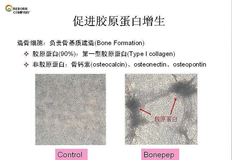 补钙选什么？当然是中国最强钙——维迈“立高多”