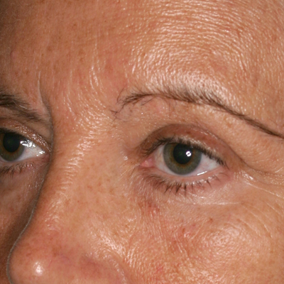 皮肤松弛,比皱纹更可怕! - 好大夫在线