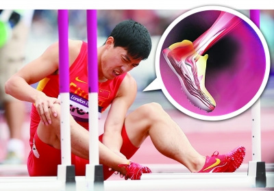 跟腱腱病 Haglund畸形与跟腱滑囊炎