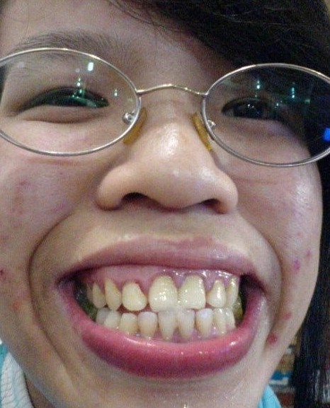 中国丑女排行榜凤姐居然未进前五心脏不好慎入